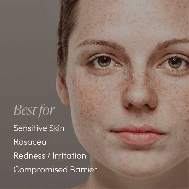 Sensitive Barrier Repair Series at Kallima Spa in Dover, DE